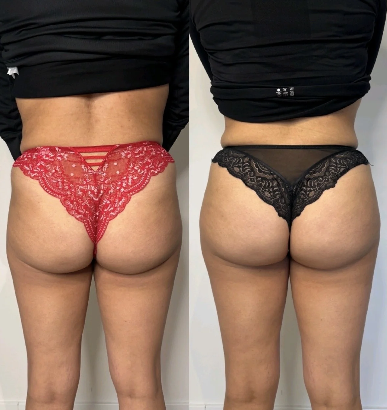 Bilfiller resultaat 1