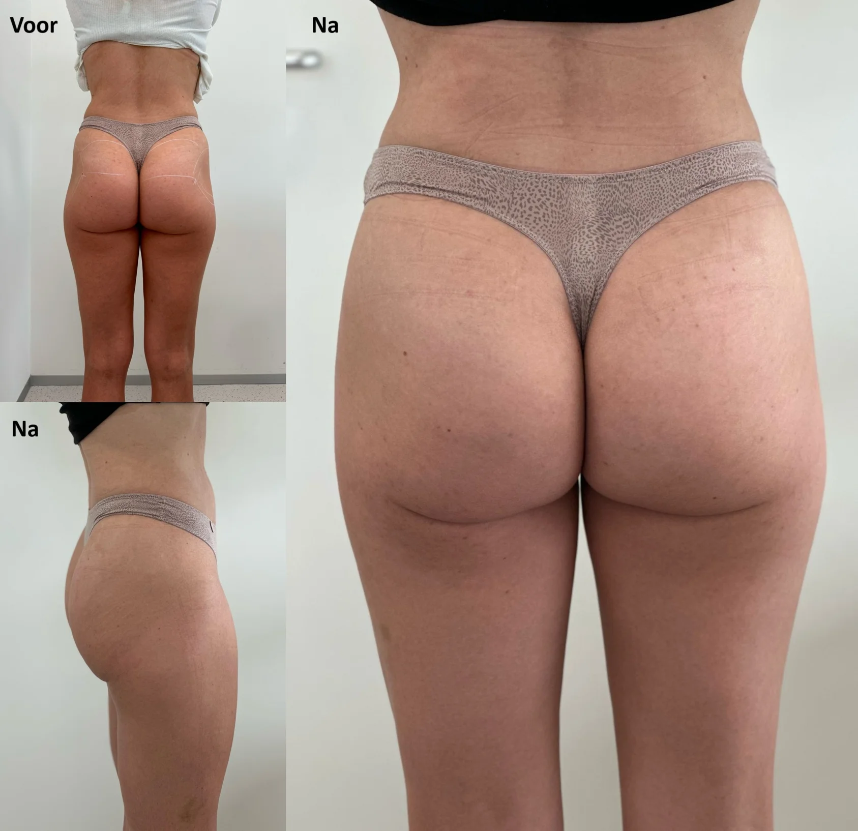 Bilfiller resultaat 2