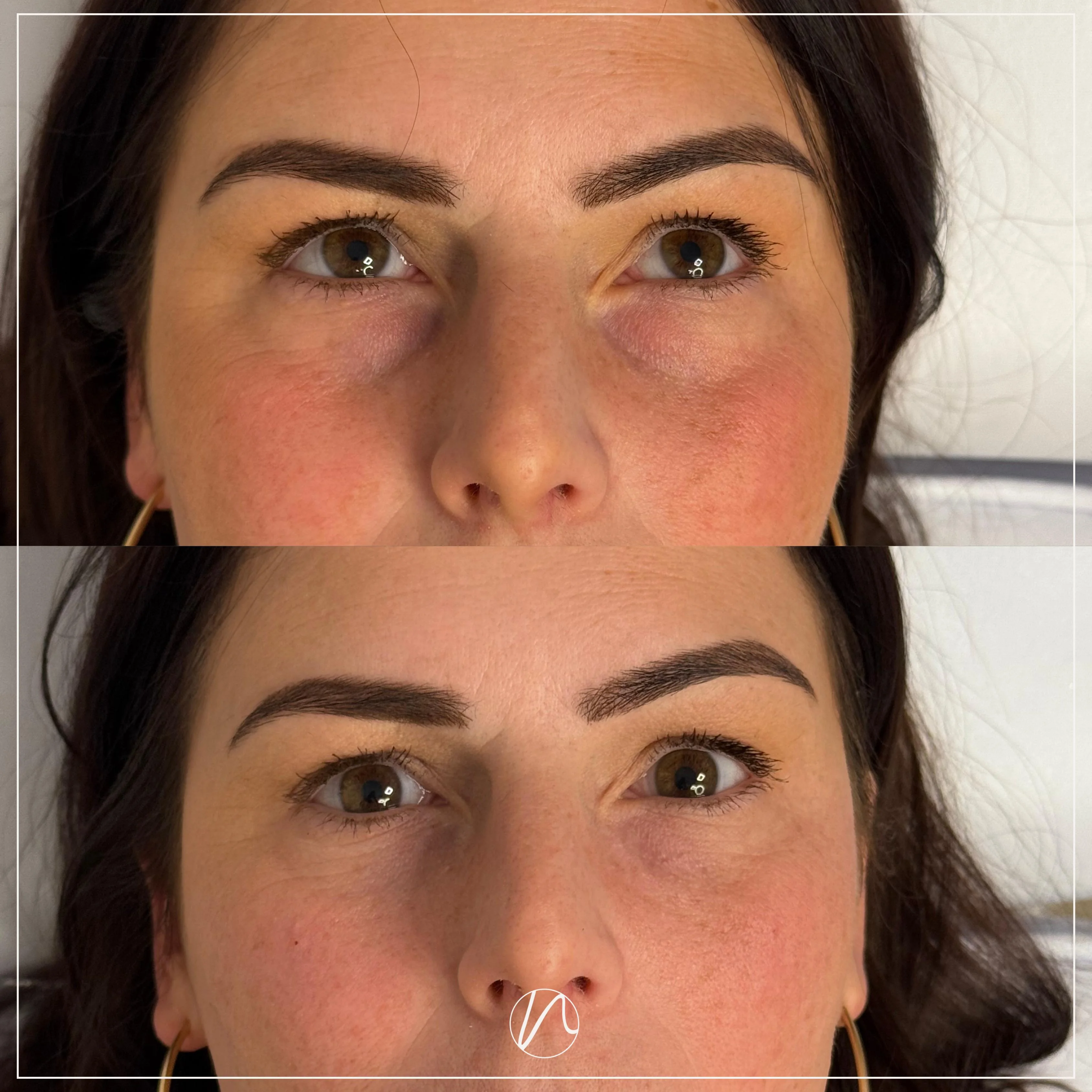 Resultaat traangootfiller - voor en na