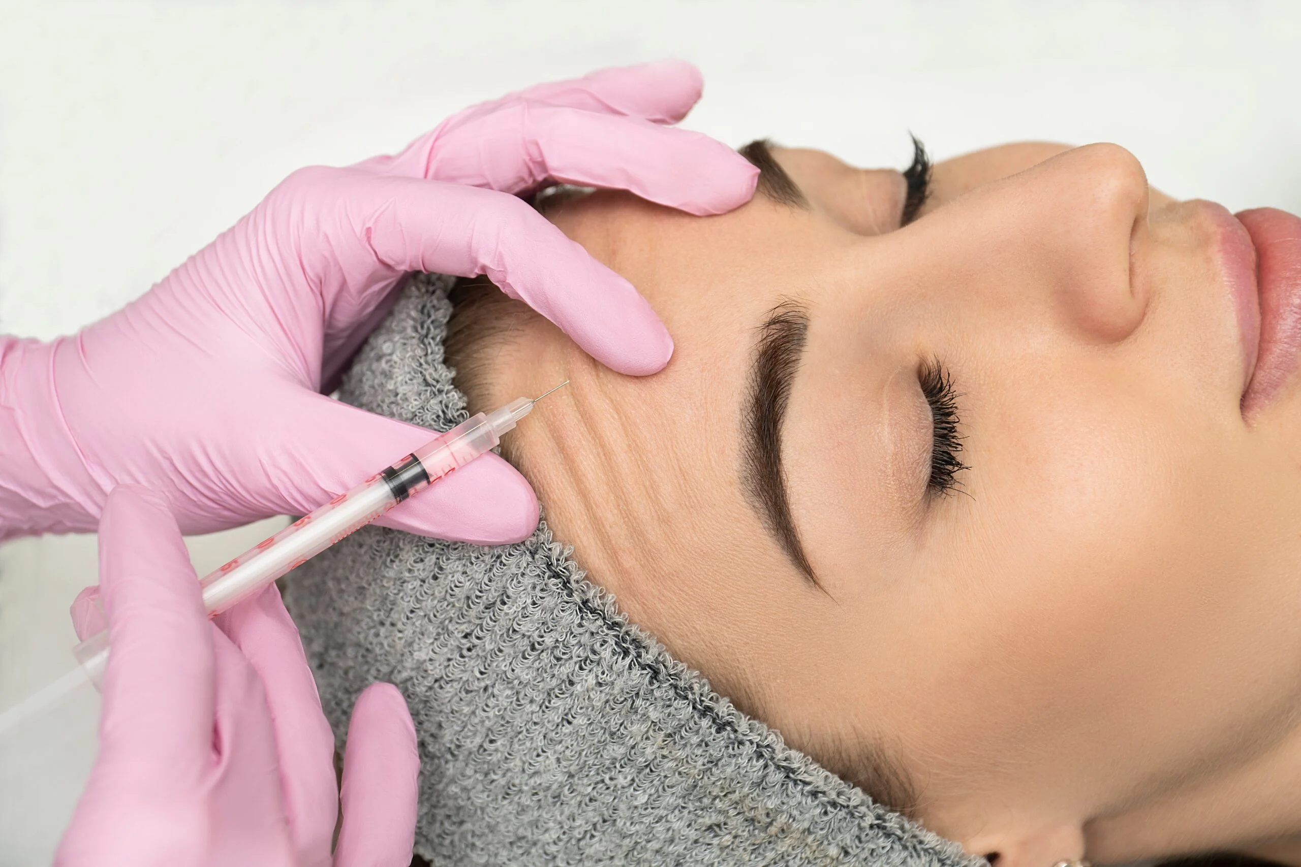 Botox Voorhoofd bij Noveve Aesthetics